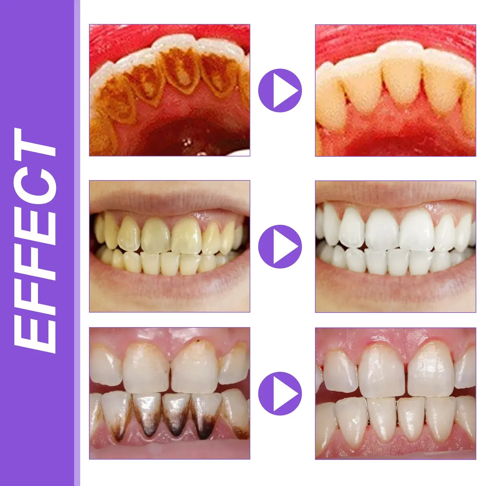 deep cleansing purple toothpaste for fresh breath and healthy gums
